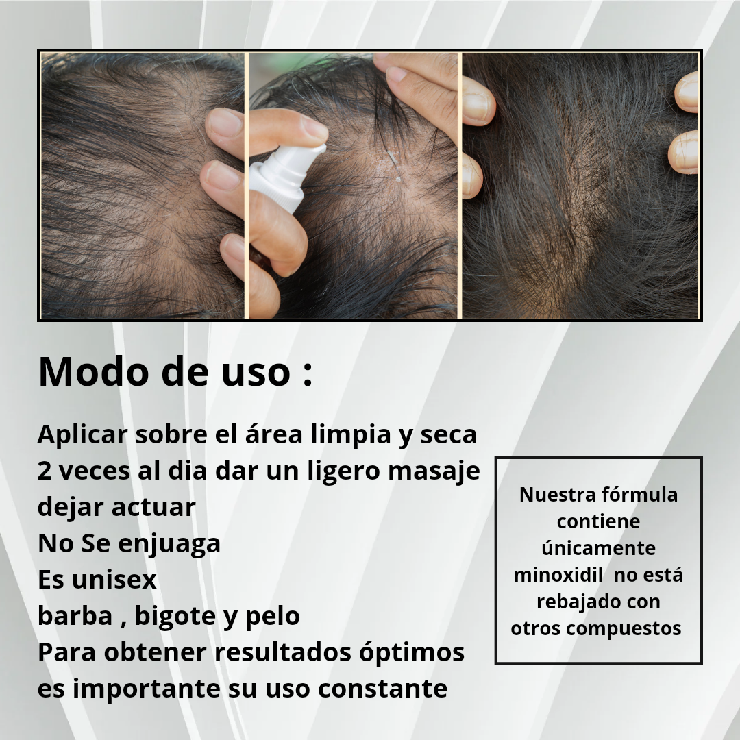 Minoxidil solución al 5%