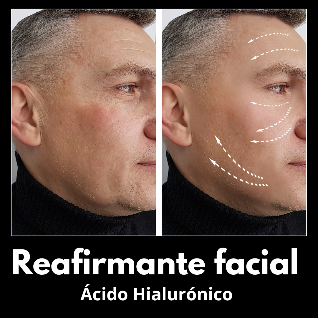 IPKYMEN reafirmante facial