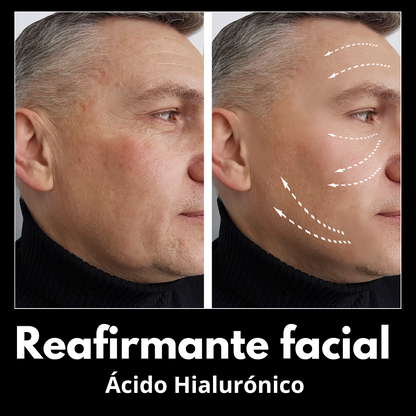 IPKYMEN reafirmante facial